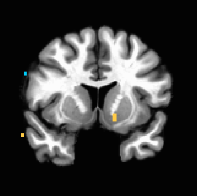 Figure 10. N=22, NAcc activation increases with subjective ratings of iconicness, p<0.001