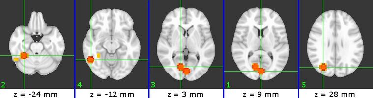 Figure 3 (B7)