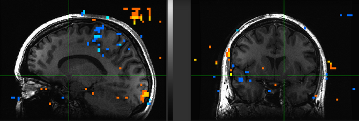 Figure 14. Subject ML.