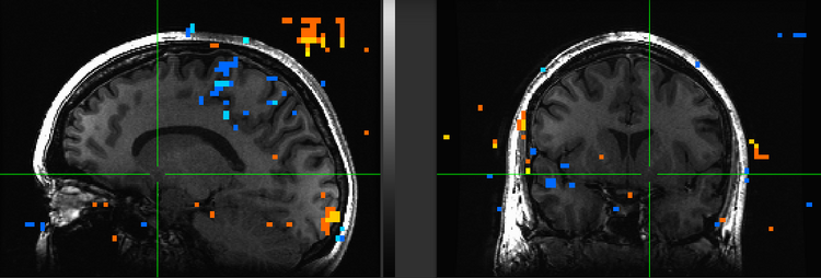Figure 14. Subject ML.