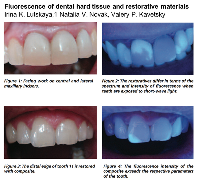 File:Dentalfluoro.png