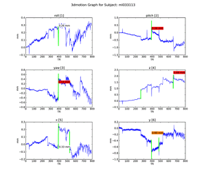 Figure 14. Subject ML.