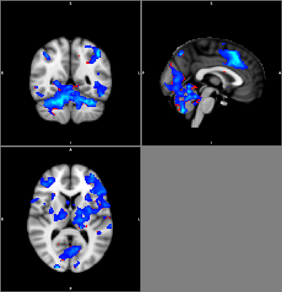 File:Corrected overlay.png