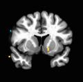 Thumbnail for version as of 18:41, 18 July 2023