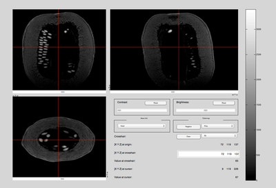 Top, Side, and Front View: Squash MRI