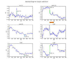 Figure 11. Subject BH.