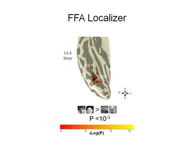 Example localized right FFA in an adolescent's brain