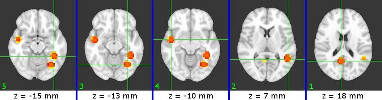 Figure 5 (W5)