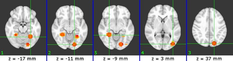Figure 4 (C4)