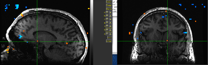Figure 11. Subject BH.