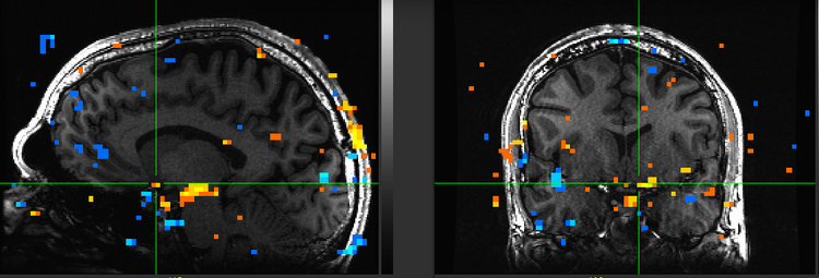 Figure 12. Subject DD.