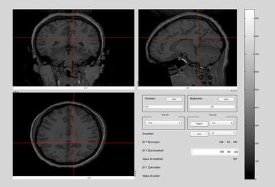 Top, Side, and Front View: Brain MRI