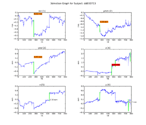 Figure 12. Subject DD.