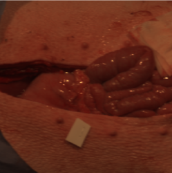 Figure 14. Stomach image 13 min after Perfusion (Ref.11)