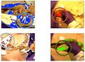 Thumbnail for version as of 18:50, 18 July 2023